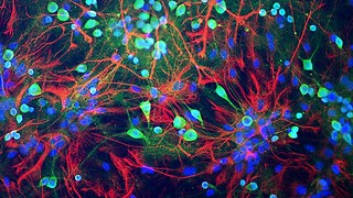 Can ‘cloaked cells’ help us cure Alzheimer's?