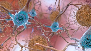 Why ‘repressed’ memories might actually be false memories