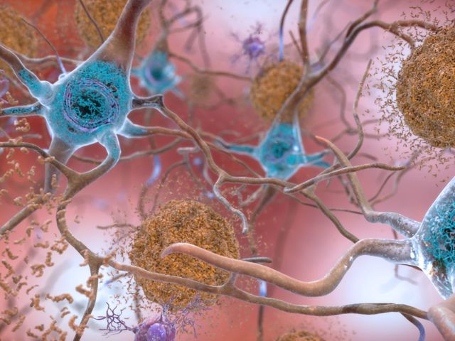 Why ‘repressed’ memories might actually be false memories