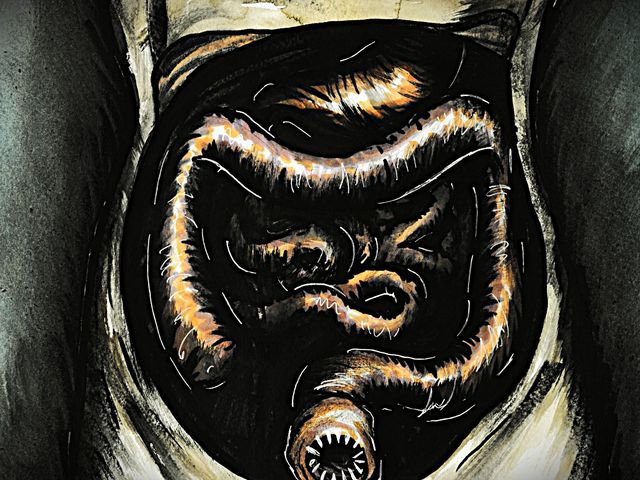 Are parasitic worms what's missing in our immune systems?